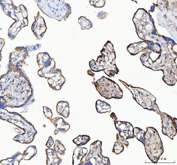 C19orf10/MYDGF Antibody