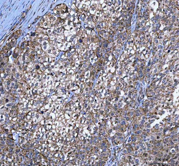 MYCBP Rabbit Polyclonal Antibody