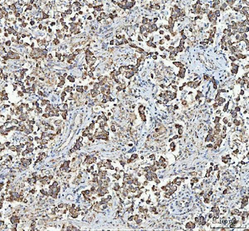MYCBP Rabbit Polyclonal Antibody
