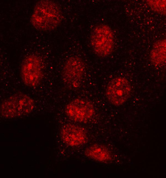 MMS19 Rabbit Polyclonal Antibody