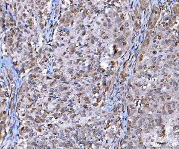 MMS19 Rabbit Polyclonal Antibody