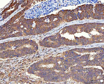 MMS19 Rabbit Polyclonal Antibody