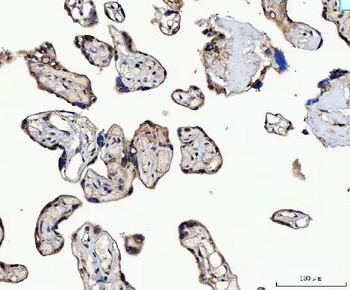 MMS19 Rabbit Polyclonal Antibody