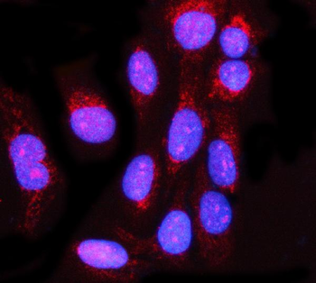 MIS12 Rabbit Polyclonal Antibody