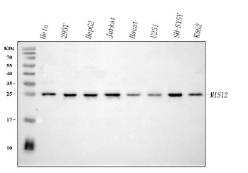 MIS12 Rabbit Polyclonal Antibody