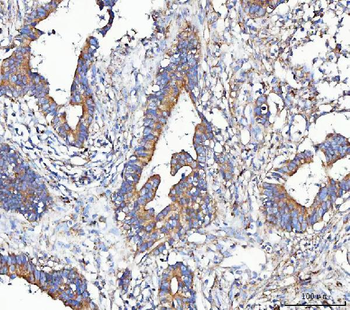 METAP2 Rabbit Polyclonal Antibody