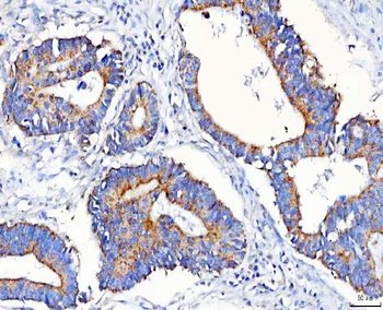 METAP1D Rabbit Polyclonal Antibody