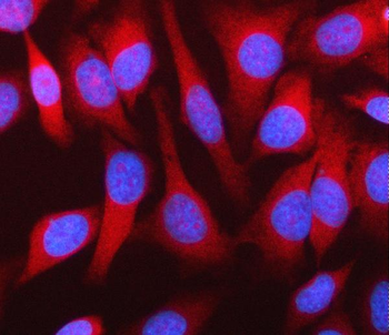 MPHOSPH9 Antibody