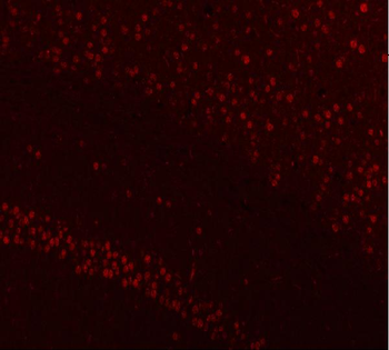 NUCKS1 Antibody