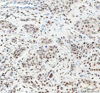 NUCKS1 Antibody
