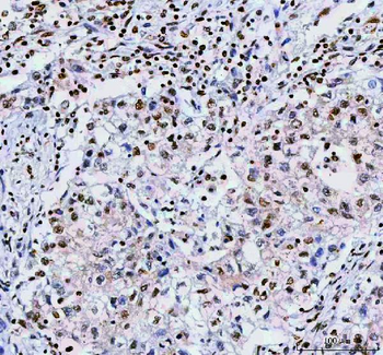 NUCKS1 Antibody