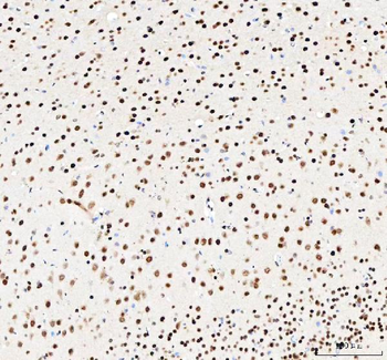 NUCKS1 Antibody