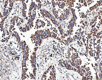 MOCS1 Antibody