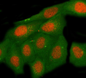 MNT Rabbit Polyclonal Antibody