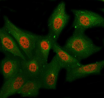 NUDCD1 Rabbit Polyclonal Antibody