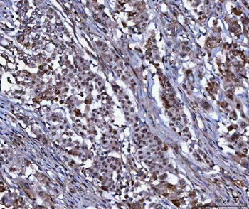 NUDCD1 Rabbit Polyclonal Antibody