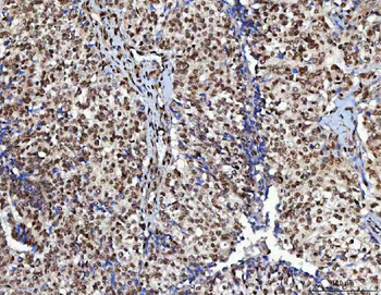 NUDCD1 Rabbit Polyclonal Antibody