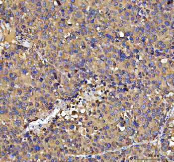 NUBPL Rabbit Polyclonal Antibody