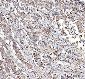 NUBPL Rabbit Polyclonal Antibody