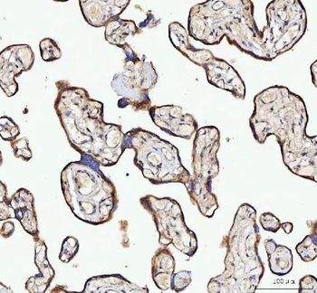 NUBPL Rabbit Polyclonal Antibody