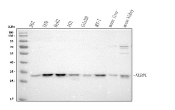 NUBPL Rabbit Polyclonal Antibody
