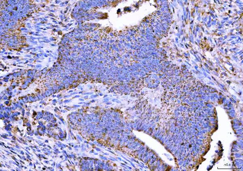 NTN3 Rabbit Polyclonal Antibody