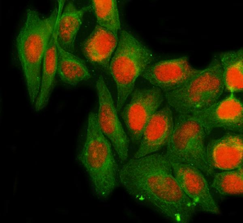 NTHL1 Rabbit Polyclonal Antibody