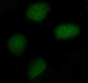 NXPE3 Rabbit Polyclonal Antibody