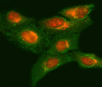 METTL11A/NTMT1 Antibody