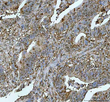 METTL11A/NTMT1 Antibody