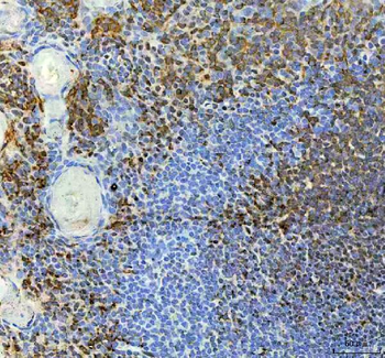 METTL11A/NTMT1 Antibody