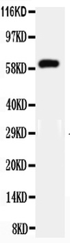 HNF1 beta/HNF1B Rabbit Polyclonal Antibody
