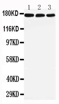LRP5 Rabbit Polyclonal Antibody