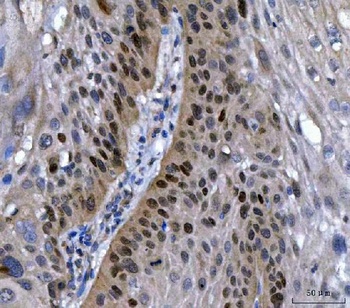 Transcription factor SOX-2 SOX2/SOX Rabbit Polyclonal Antibody