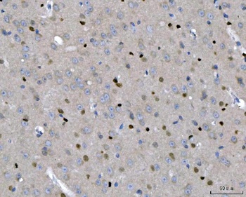 Transcription factor SOX-2 SOX2/SOX Rabbit Polyclonal Antibody