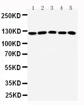 ST5 Rabbit Polyclonal Antibody