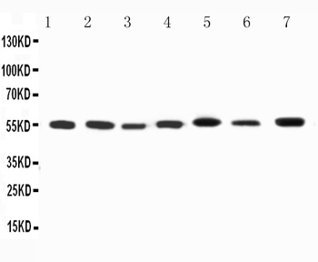 Kv1.1 potassium channel/KCNA1 Rabbit Polyclonal Antibody