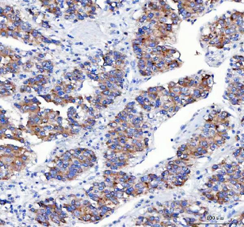 APLP2 Rabbit Polyclonal Antibody