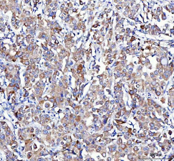 APLP2 Rabbit Polyclonal Antibody