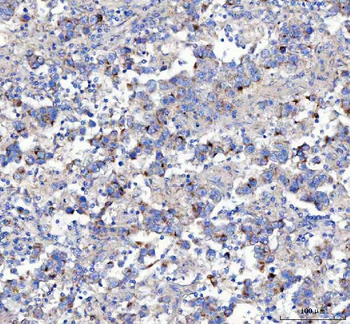 APLP2 Rabbit Polyclonal Antibody