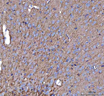 APLP2 Rabbit Polyclonal Antibody