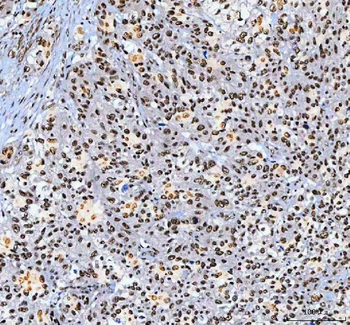AHRR Antibody