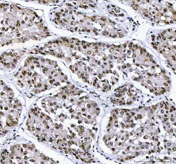 AHRR Antibody