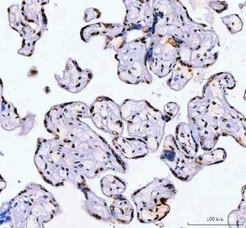 AHRR Antibody