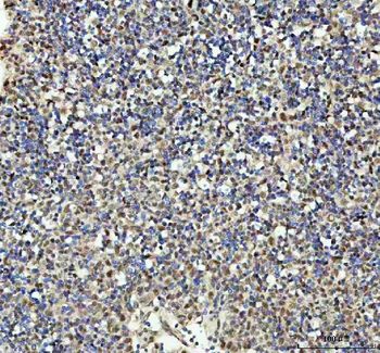 PSIP1 Rabbit Polyclonal Antibody