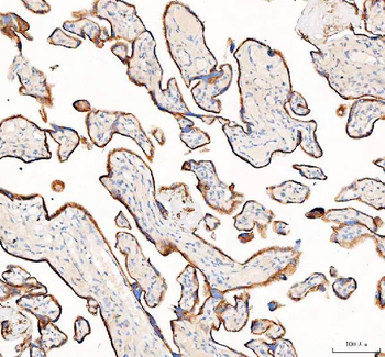 AGL Rabbit Polyclonal Antibody