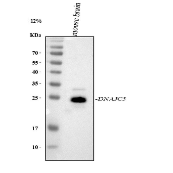 DNAJC5 Rabbit Polyclonal Antibody