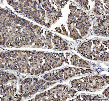 MAGEL2 Rabbit Polyclonal Antibody