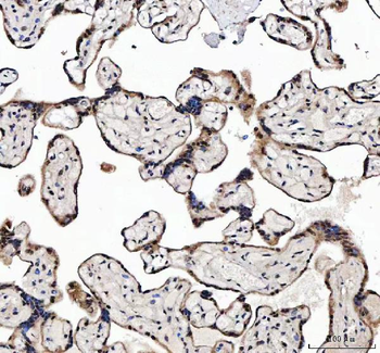 MAGEL2 Rabbit Polyclonal Antibody