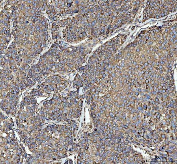 RPL18 Antibody